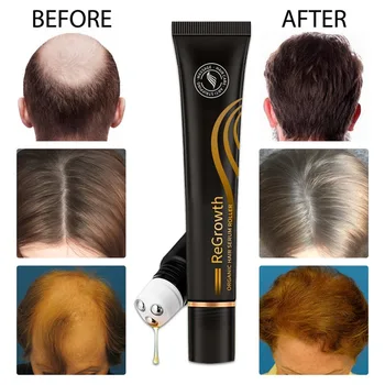 20ml Zadebelitev Anti Hair Loss rast Dlak Bistvo Naravne Neguje Lasišče rast Dlak Zdravljenja za Nego Las